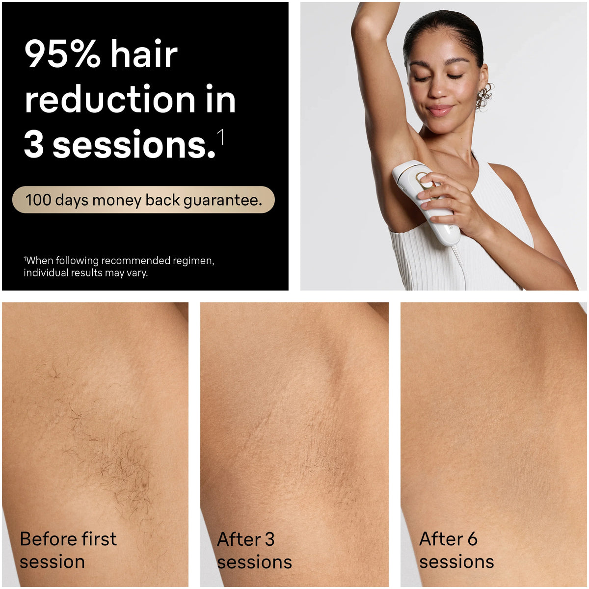 Braun Smart IPL, Silk·Expert Pro 5: At Home Alternative to Laser Hair Removal with 4 Caps, Facial Hair Trimmer, and Vanity Case, IPL5442